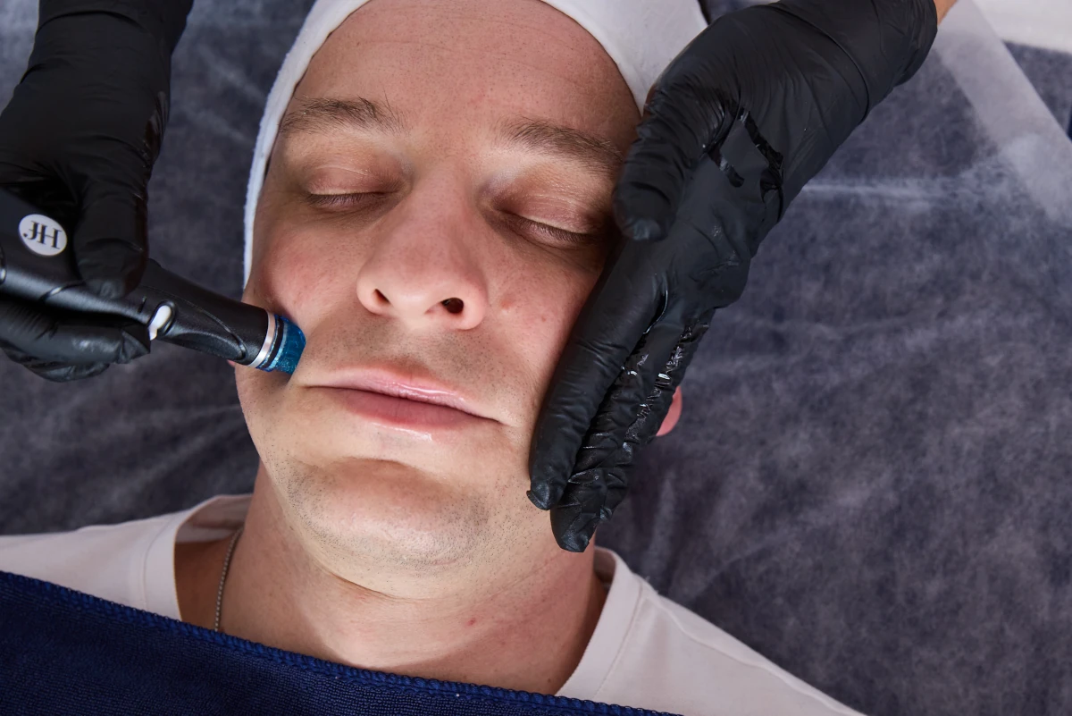 Estetika Hydrafacial